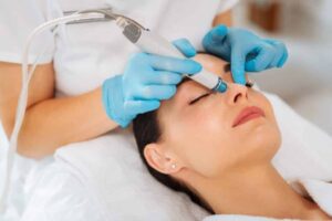 hydrafacial tratamento de rosto