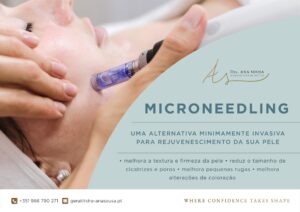 Microneedling - dra ana sousa